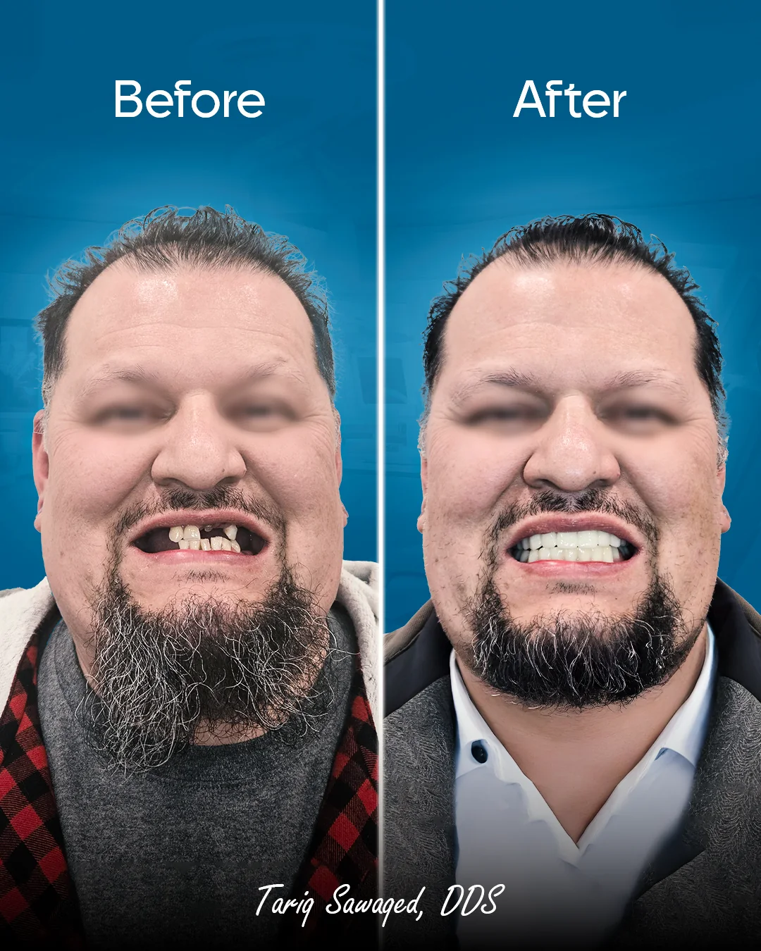 Before and after smile transformation, result 8
